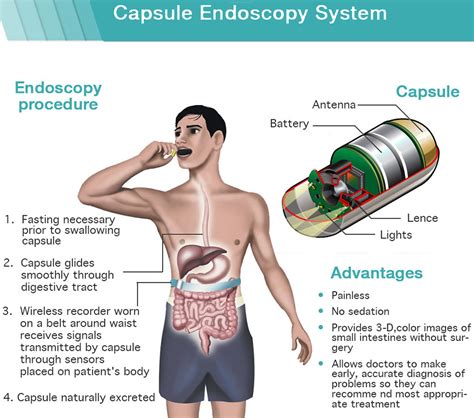 video capsule endoscopy protocol